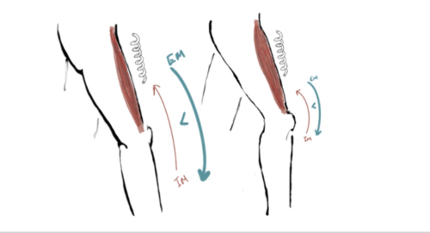 <p>IM: Knee Extension (quads)</p><p>EM: Knee flexion</p><p>IM</p>