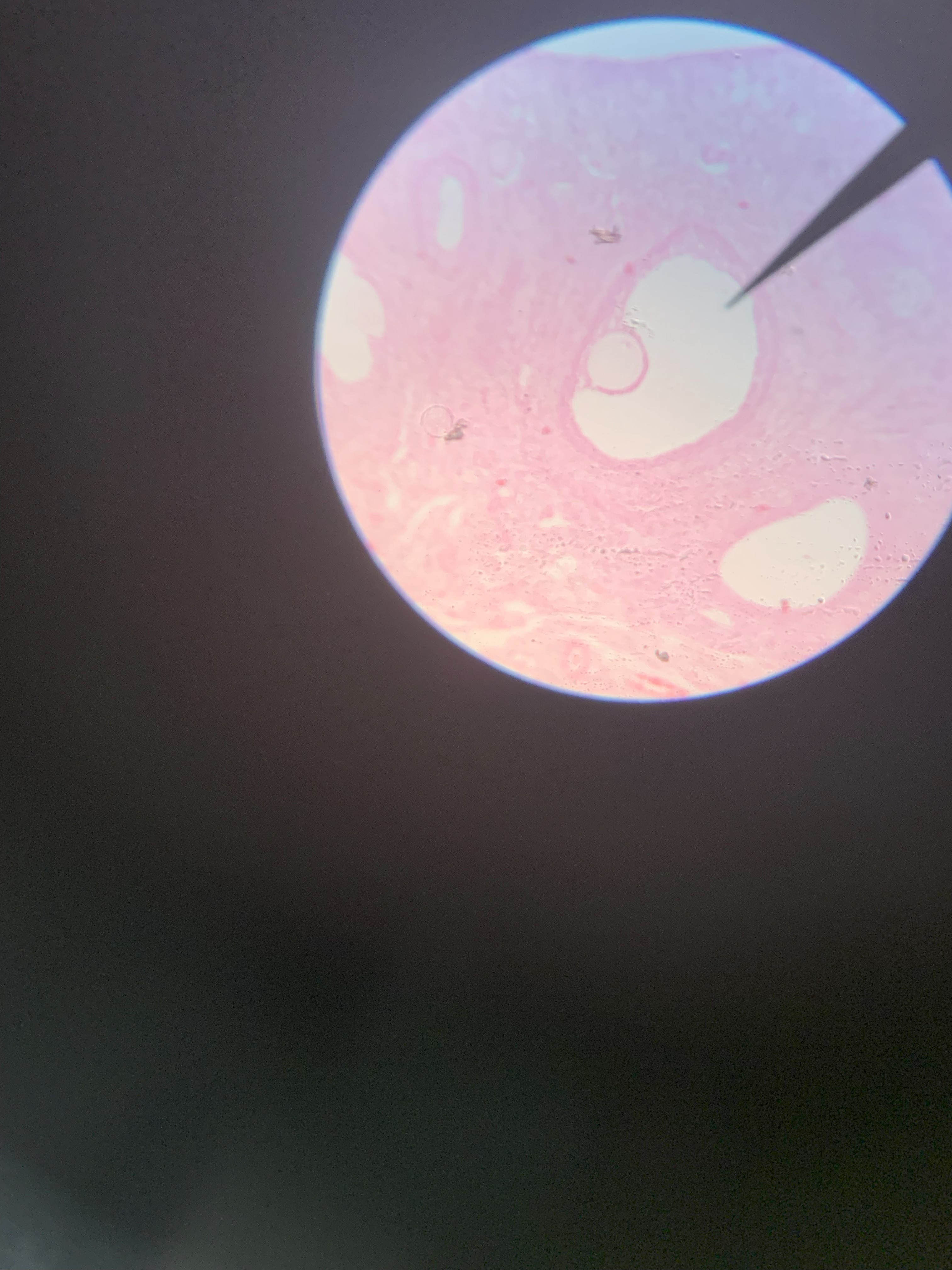 <p>Identify the tissue seen through the microscope</p>