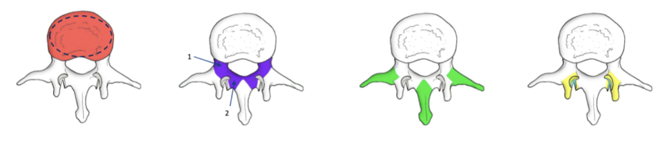 <p><span><strong>Major anatomical landmarks of typical vertebra</strong></span></p>