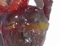 <p>What degenerative condition can occur due to lipid deposits in the vessel wall, increased cholesterol, hypothyroidism, increased LDL, atheroma, yellow-thick arteries, foam cells on the tunica intima, thrombosis, and ischemia? Birds are especially prone to this.</p>