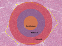 <p><span style="background-color: transparent;">General Hepatic Injury</span></p>