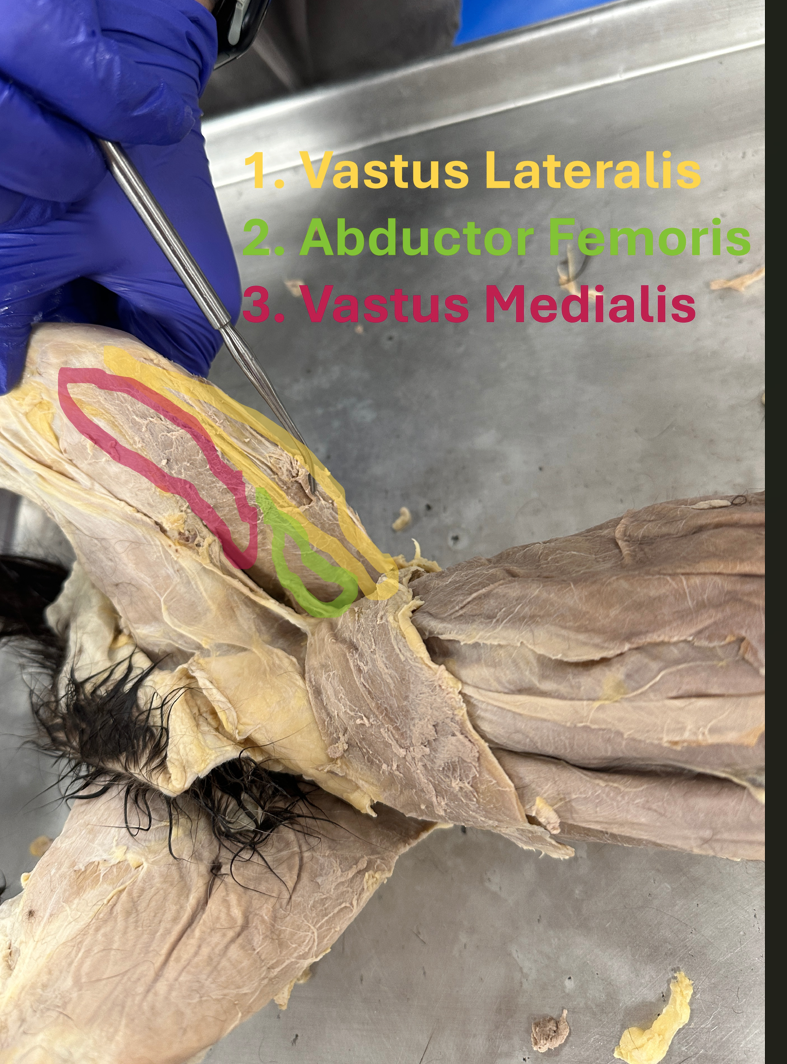 <p>Vastus medialis (hindlimb deep muscle)</p>