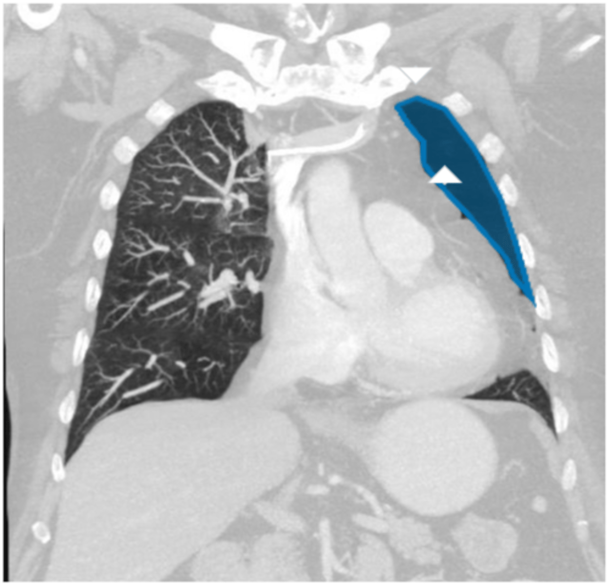 <p>Label pathology in image below</p>