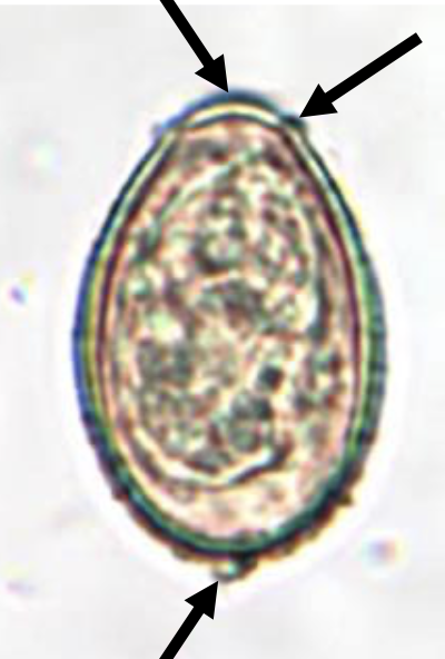 <ul><li><p>30 × 15 um</p></li><li><p>operculum</p></li><li><p>shoulders</p></li><li><p>abopercular knob </p></li></ul>