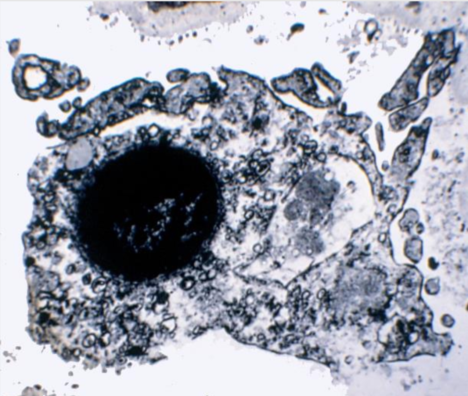 term image