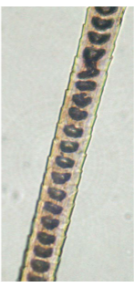 <p>The medulla pattern in the image may be classified as being:</p><p>A. Lattice.</p><p>B. Ladder.</p><p>C. Globular.</p><p>D. Discontinuous.</p><p>E. Aeroform</p>