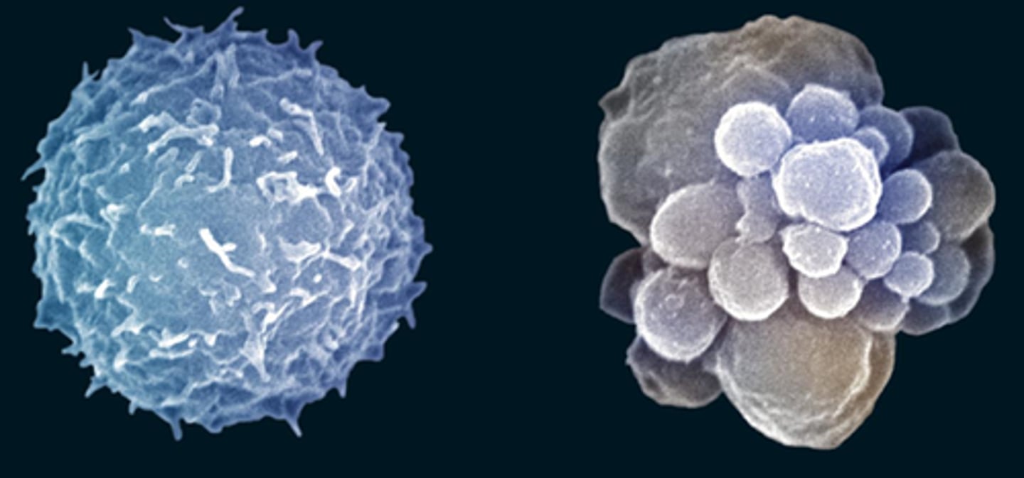 <p>A program of controlled cell suicide, which is brought about by signals that trigger the activation of a cascade of suicide proteins in the cell destined to die.</p>