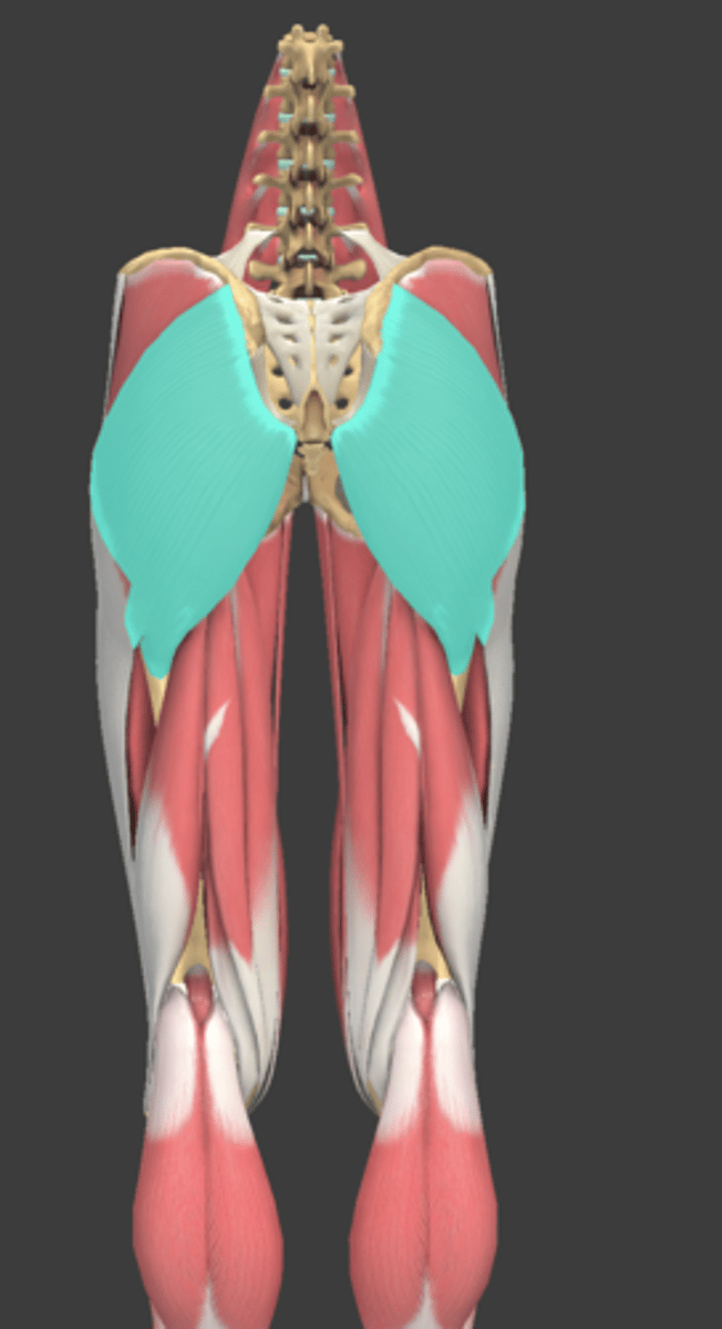 <p>What Muscle Is Highlighted?</p>