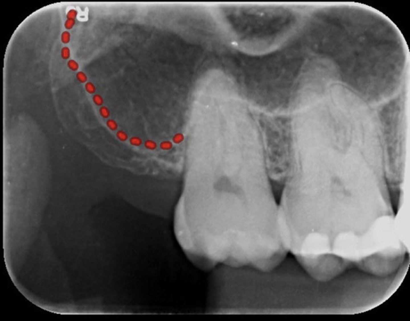 <p>What is the red dotted line representing?</p>