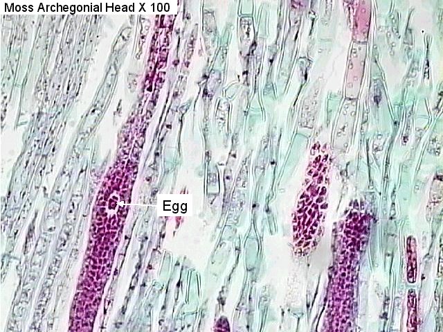This is an archegonia/antheridia?