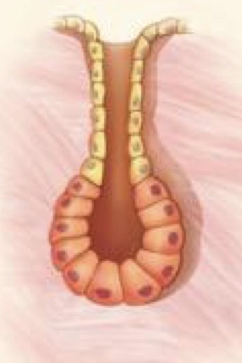<p>What gland duct type is this?</p>
