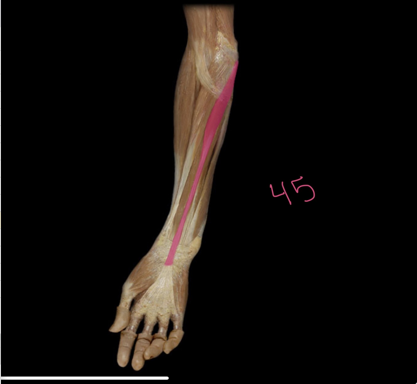 <p>Palmaris longus</p>