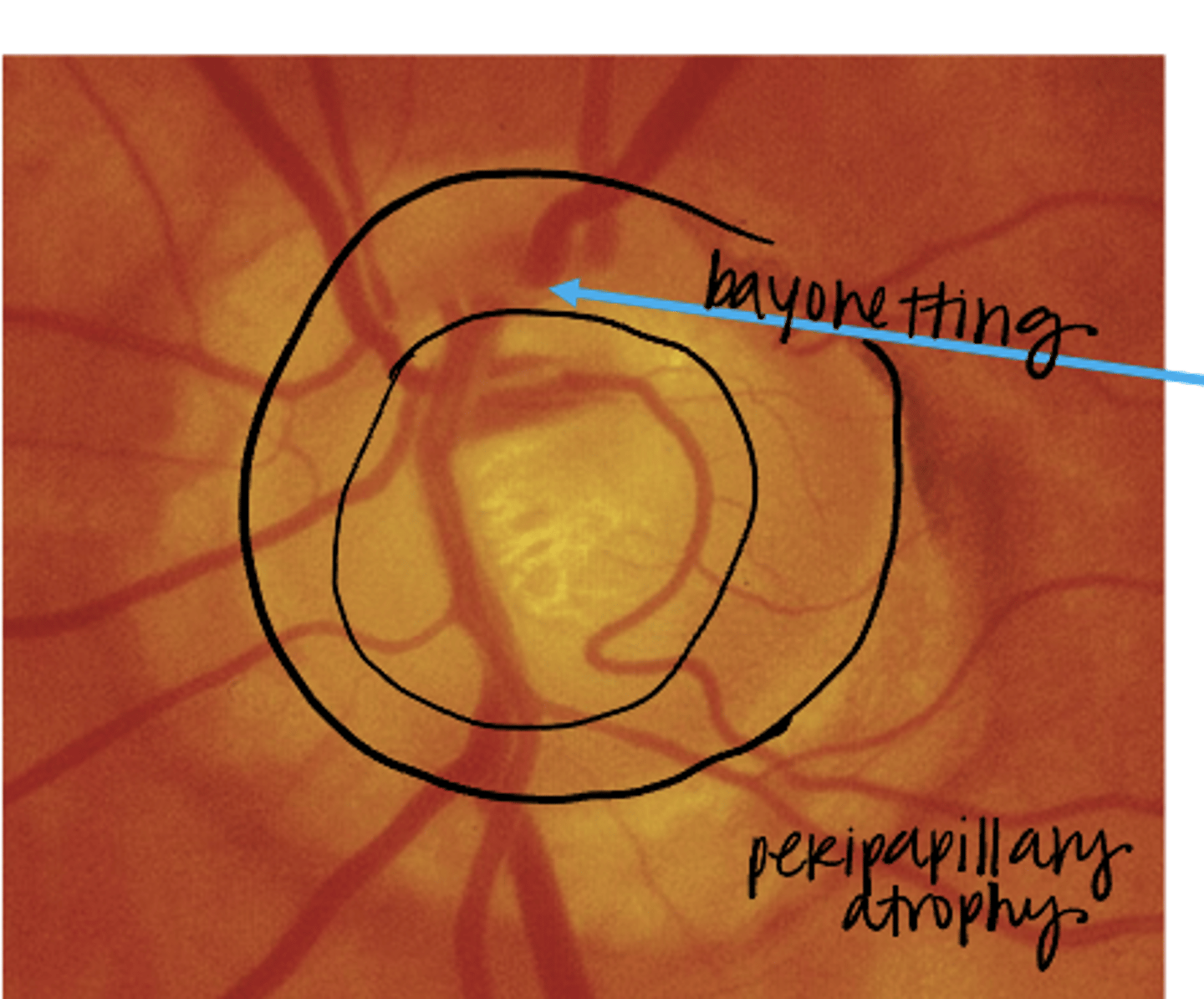 <p>Does this nerve follow the ISNT rule?</p>