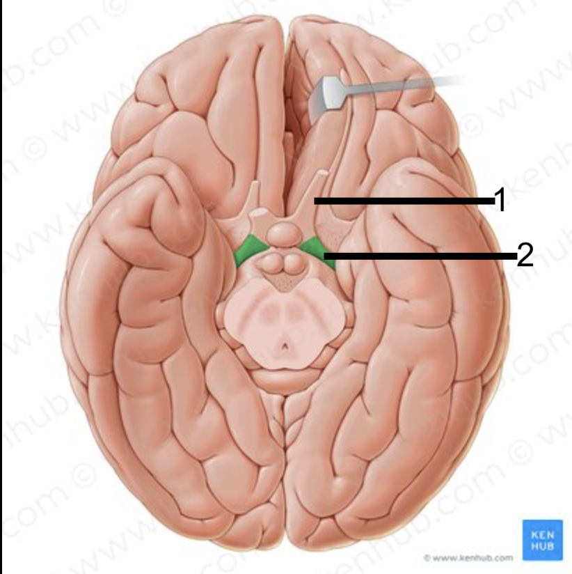 <p>What structure of the brain is this? #1</p>