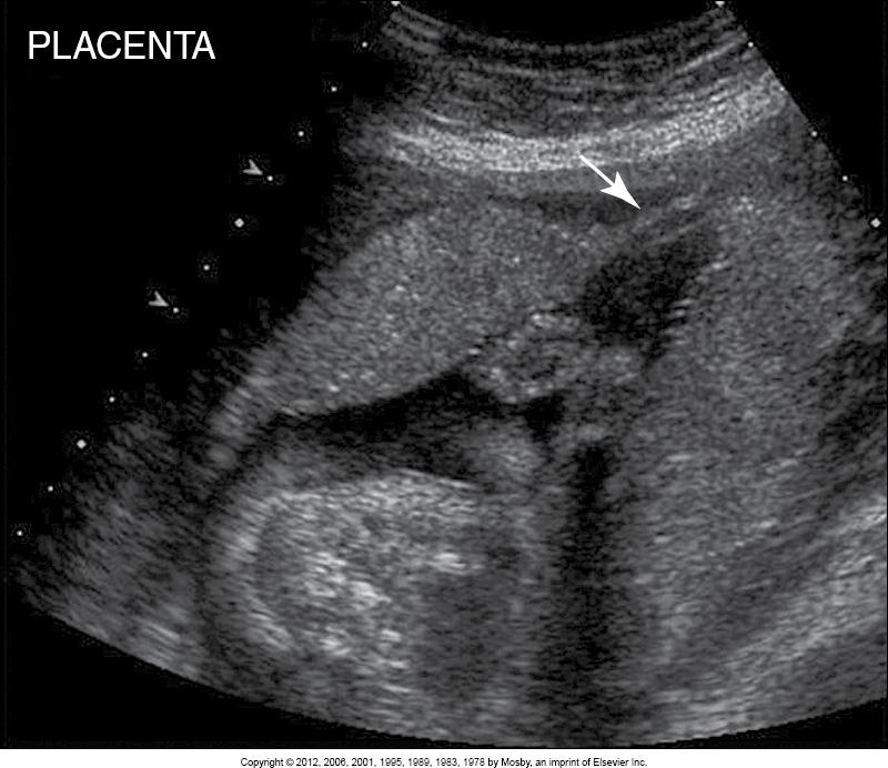 <p>What does this image show?</p>