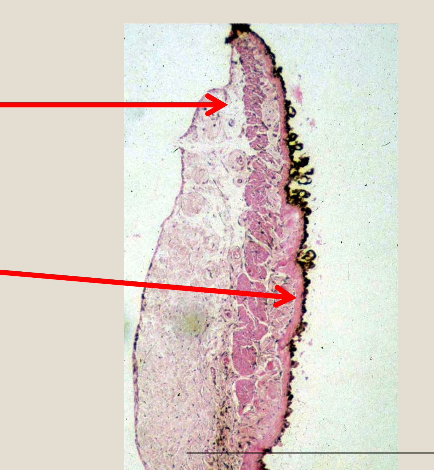 <p>from top top to bottom label the structures of the iris</p>