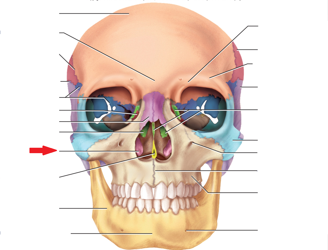 term image