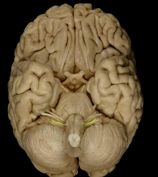 <p>List the nerve name, roman numeral, and function.</p>