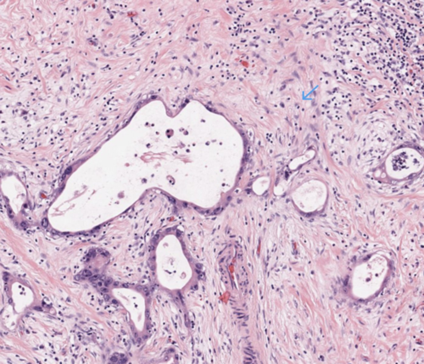 <p>Pancreas</p>