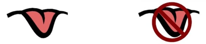 <p><strong>PTC tasting</strong></p><p>- <span class="bgP">dominant</span></p><p>- 75% of individuals can taste the bitter flavor of PTC</p><p></p><p><strong>Non-tasting</strong></p><p>- <span class="bgP">recessive</span></p><p>- 25% of individuals find the PTC paper tasteless</p><p></p><p>*PTC is a bitter flavor compound that often causes people to dislike certain foods, such as broccoli, coffee, or beer</p>