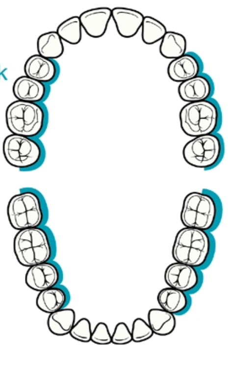<p><strong>What posterior aspect is this to the clinician, and what clock position?</strong></p>