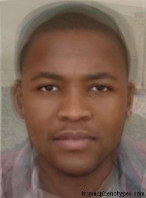 <p>Identify this Phenotype</p>