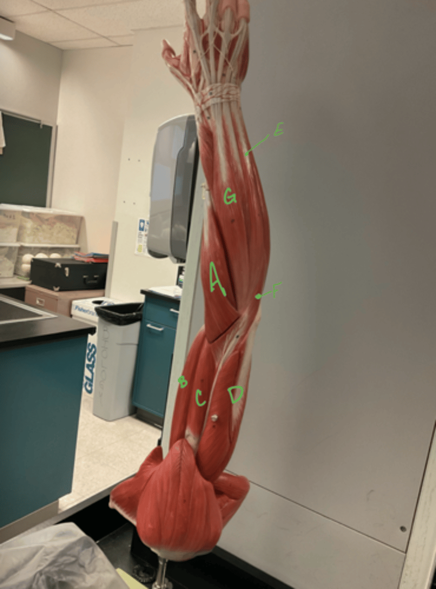 <p>extensor carpi ulnaris</p>