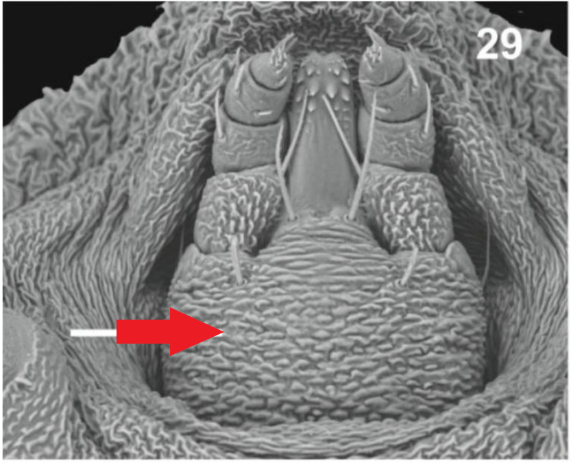 identify the pointed structure