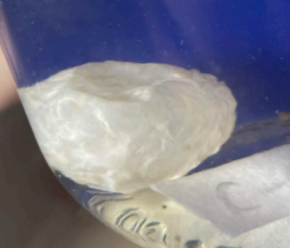 <p>name of larval stage and of which parasite?</p>