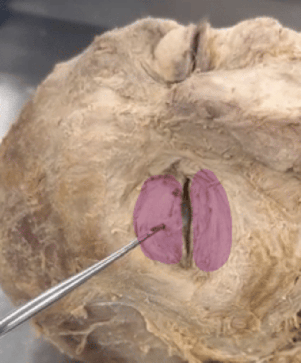 <p>Name the muscle.</p>