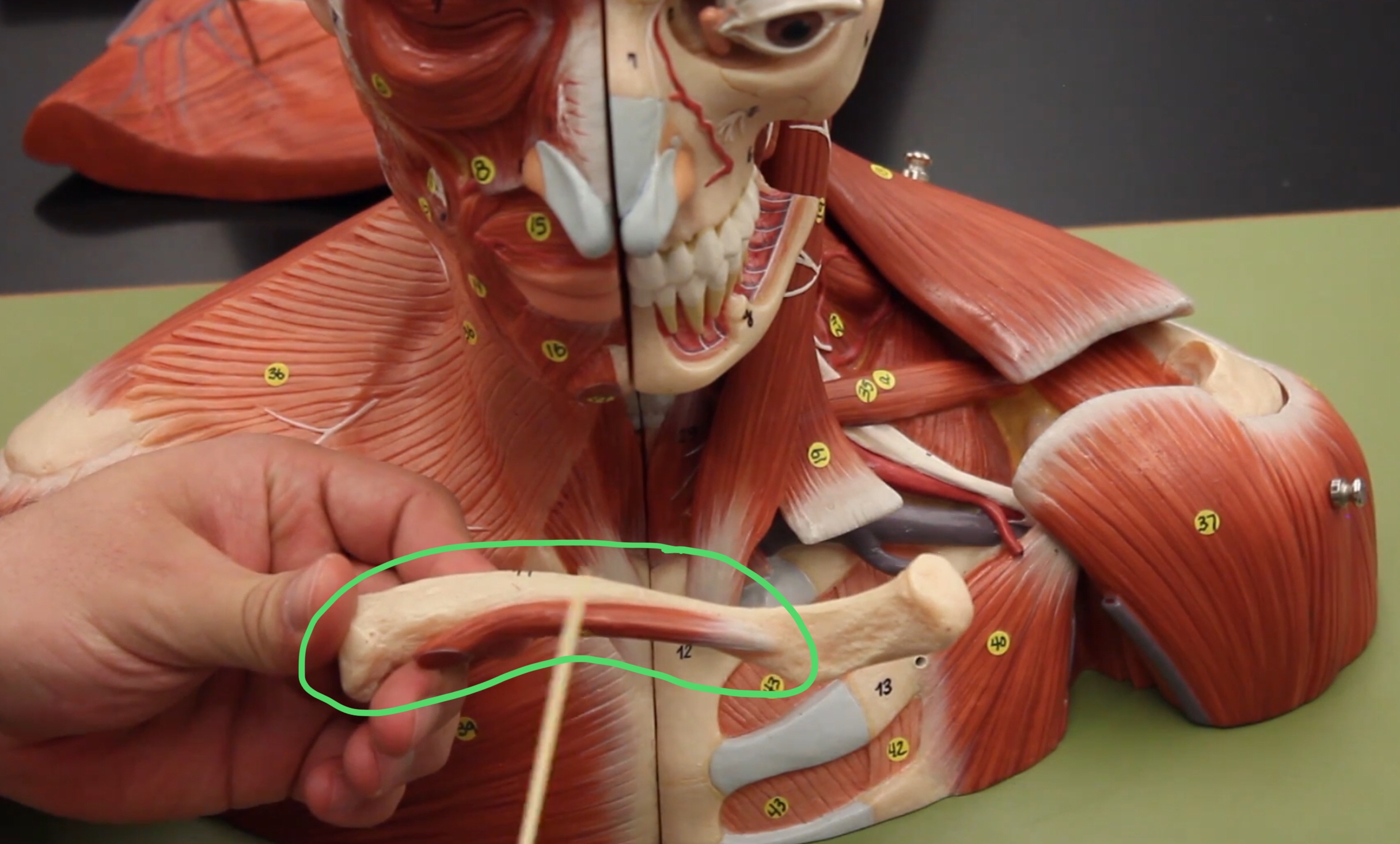 term image