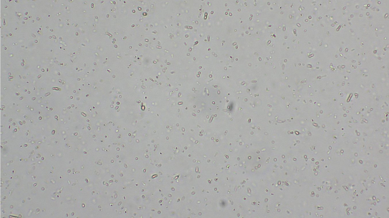 <p>Aerobic heterotrophs when oxygen is present, but phototrophs most of the time due to lack of oxygen. Use bacteriorhodopsin to generate ATP. Halophile</p><p>Domain: Archaea<br>Shape: Bacillus</p><p>Movement: Motile-flagellum</p><p>Metabolic features: heterotrophic in oxygen rich environments, phototrophic in low oxygen environments</p>