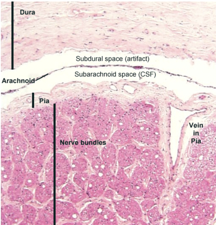 <ul><li><p>Thick dural layer</p></li><li><p>Thin arachnoid layer</p></li><li><p>CSF filled space</p></li><li><p>Thin pia layer</p></li></ul><p></p>