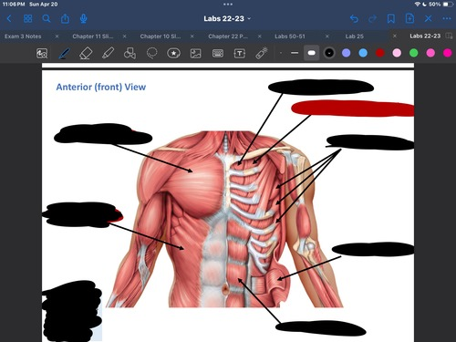 <p>What muscle is this?</p>