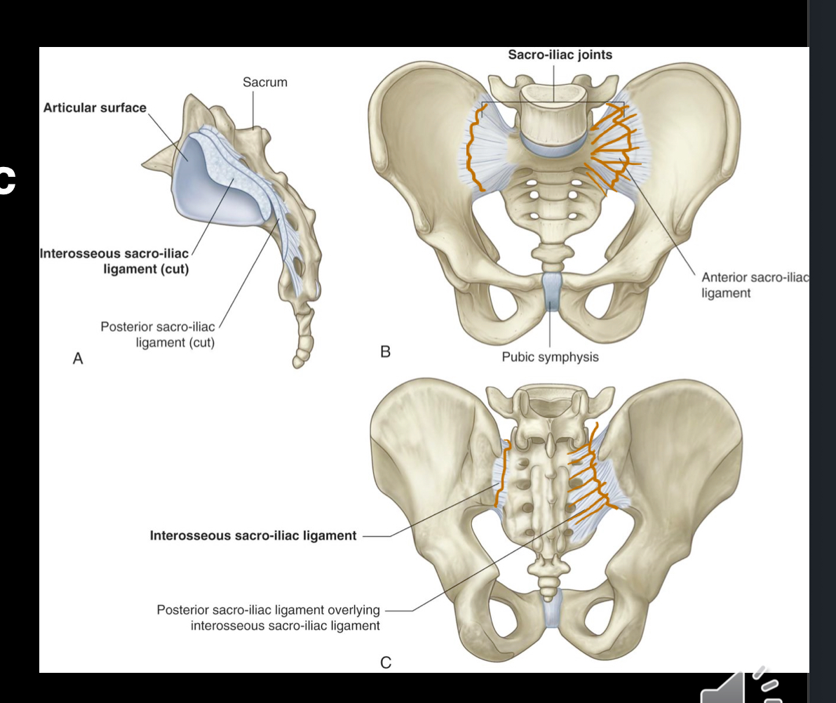 <p>Sacroiliac joints</p><ul><li><p>Between sacrum and ilium of os coxae</p></li><li><p>Transmits forces from lower limbs to axial skeleton</p></li></ul><p>Pubic Symphysis</p><p></p>