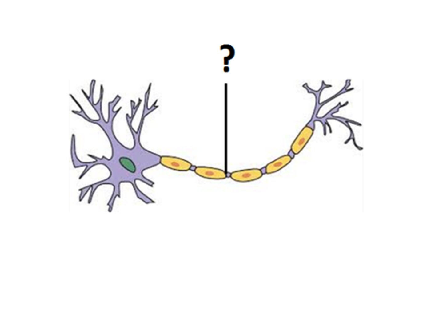 <p>long stem of the neuron</p>