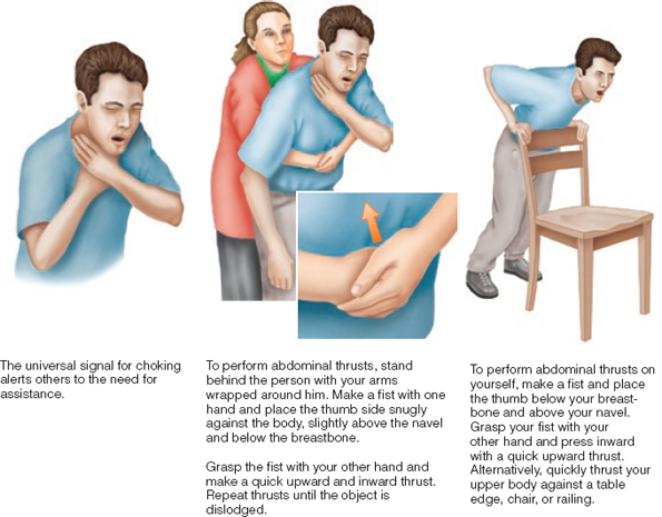 <p>As soon as possible, shout for help and call 9-1-1. If possible, get consent to begin first aid. First aid for choking relies on abdominal thrusts, repeated until the object is forced out, the person can cough or breathe, or the person becomes unconscious. In the case of someone losing consciousness, carefully lower the person to the floor. </p>