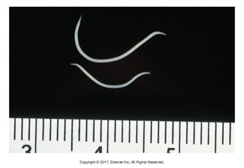 <p>"Esophagus mouth"</p><ul><li><p>Found: Worldwide</p></li><li><p>Nodular worm of pigs​</p></li><li><p>Large intestine​</p></li><li><p>Larval form causes nodules to form in the large intestine, can cause obstruction​</p></li><li><p>Prepatent period: 50 days​</p></li><li><p>Strongyle type egg​</p></li><li><p>Symptoms: Anorexia, diarrhea,​ weight loss</p></li></ul><p></p>