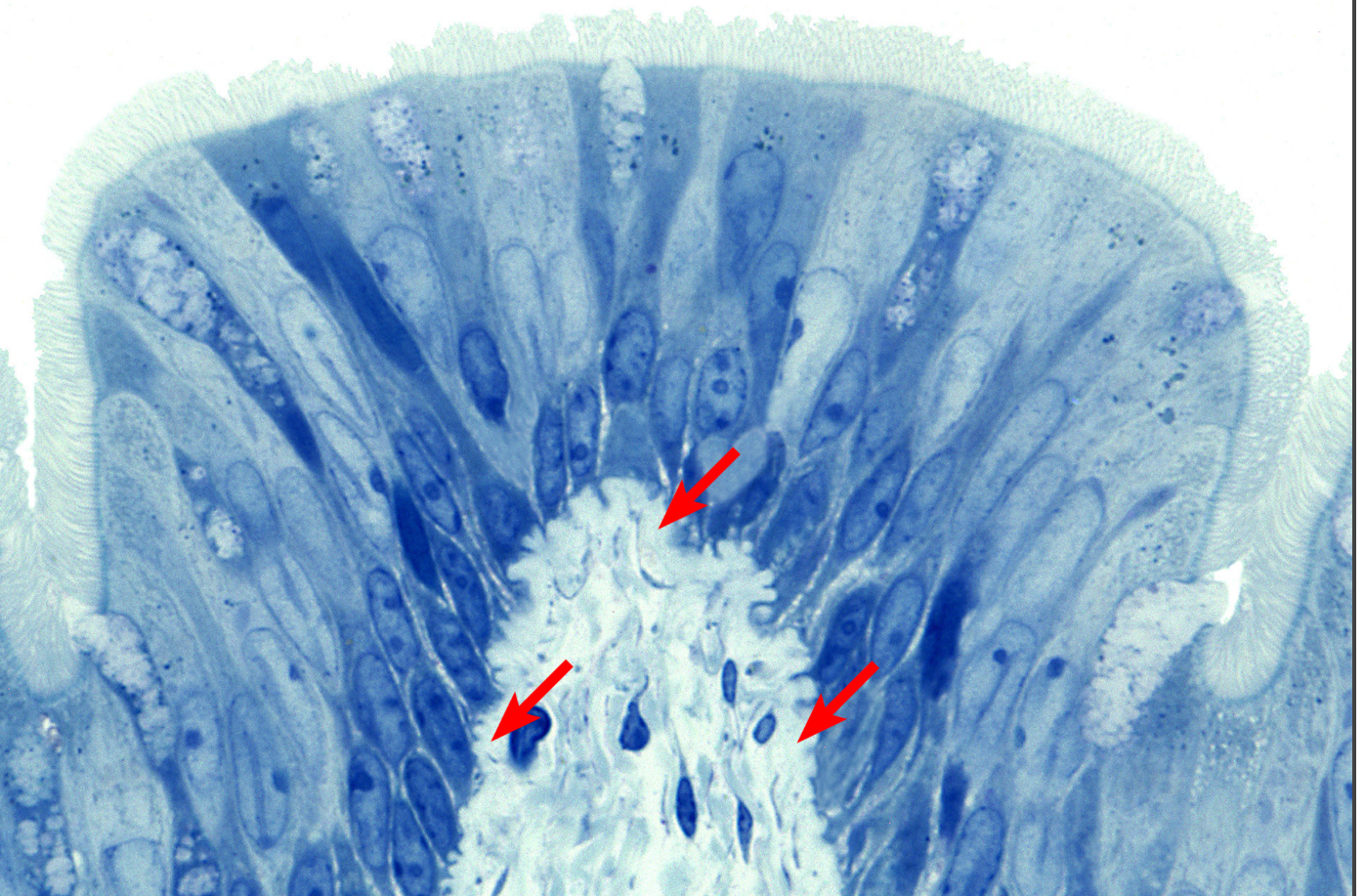 <p>Basement Membrane</p>