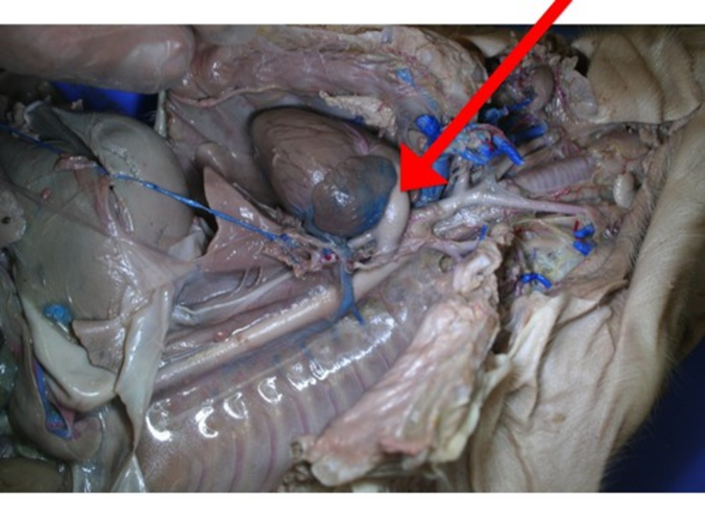<p>carries deoxygenated blood from the right ventricle to the lungs.</p>
