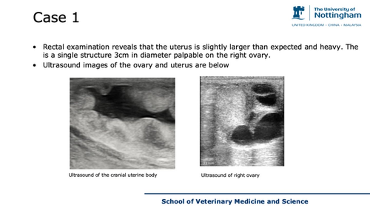 <p>case 1 - what can you see on this ultrasound</p>