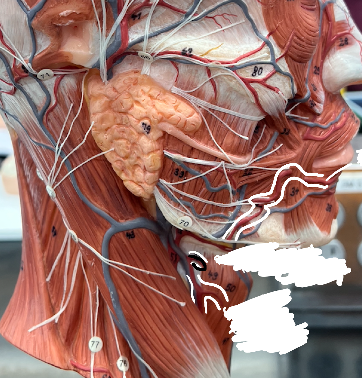 <p>The top forked part coming off the superior thyroid artery</p>