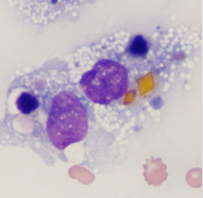 <p>Body cavity effusions</p><p>What is this?</p><p>DX?</p>