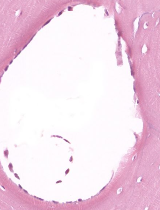 <p>cells found on the inner surface of some canals</p>
