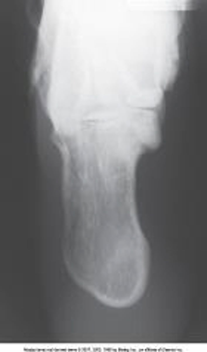 <p>What is the projection and anatomy of interest in the image below?</p><p>AP axial calcaneus</p><p>AP calcaneus</p><p>Plantodorsal axial calcaneus</p><p>Superoinferior axial calcaneus</p>