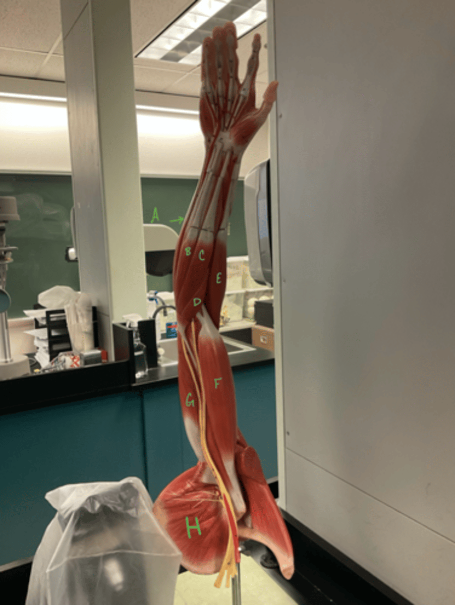 <p>flexor carpi ulnaris</p>