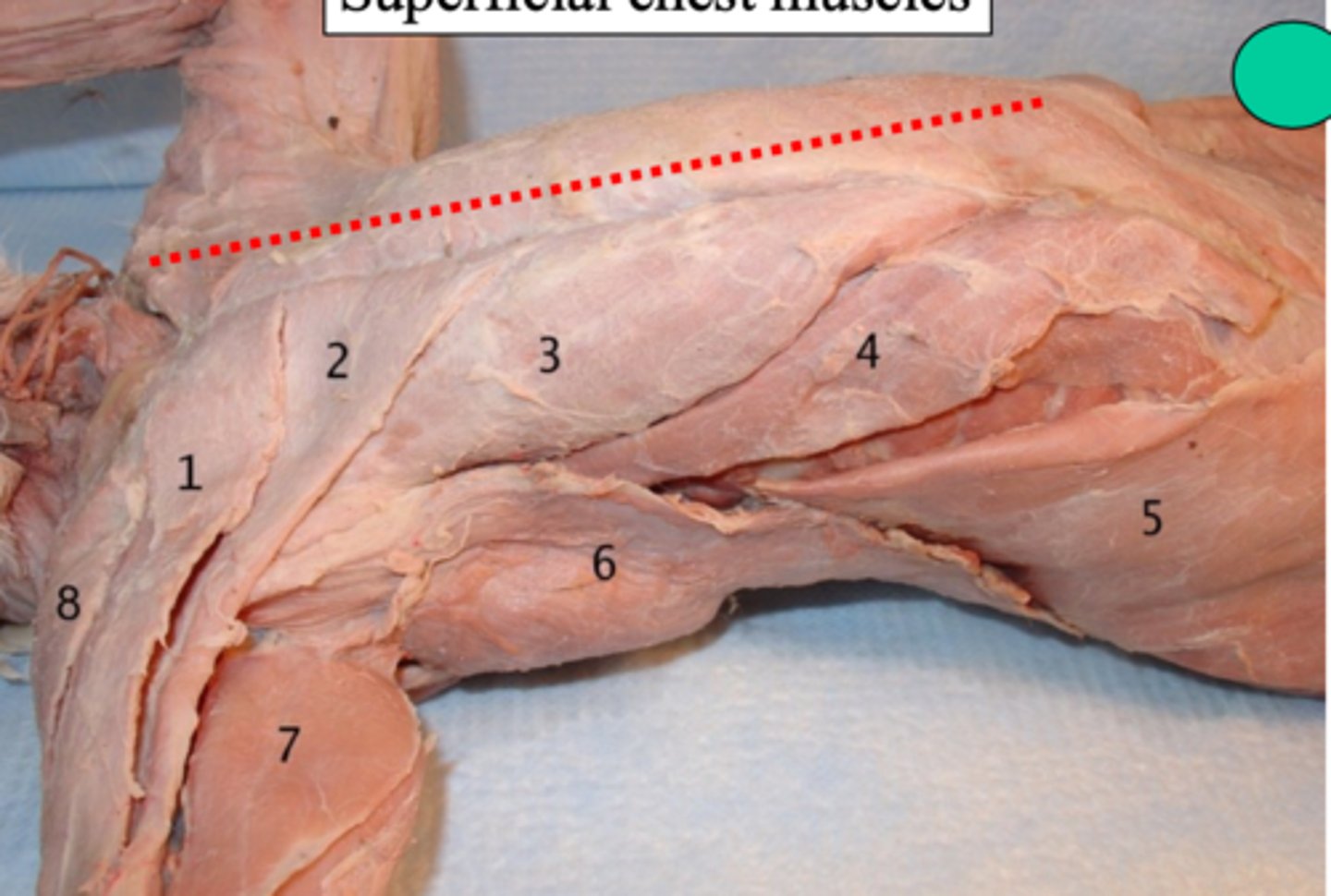 <p>What superficial chest muscle is number 6?</p>