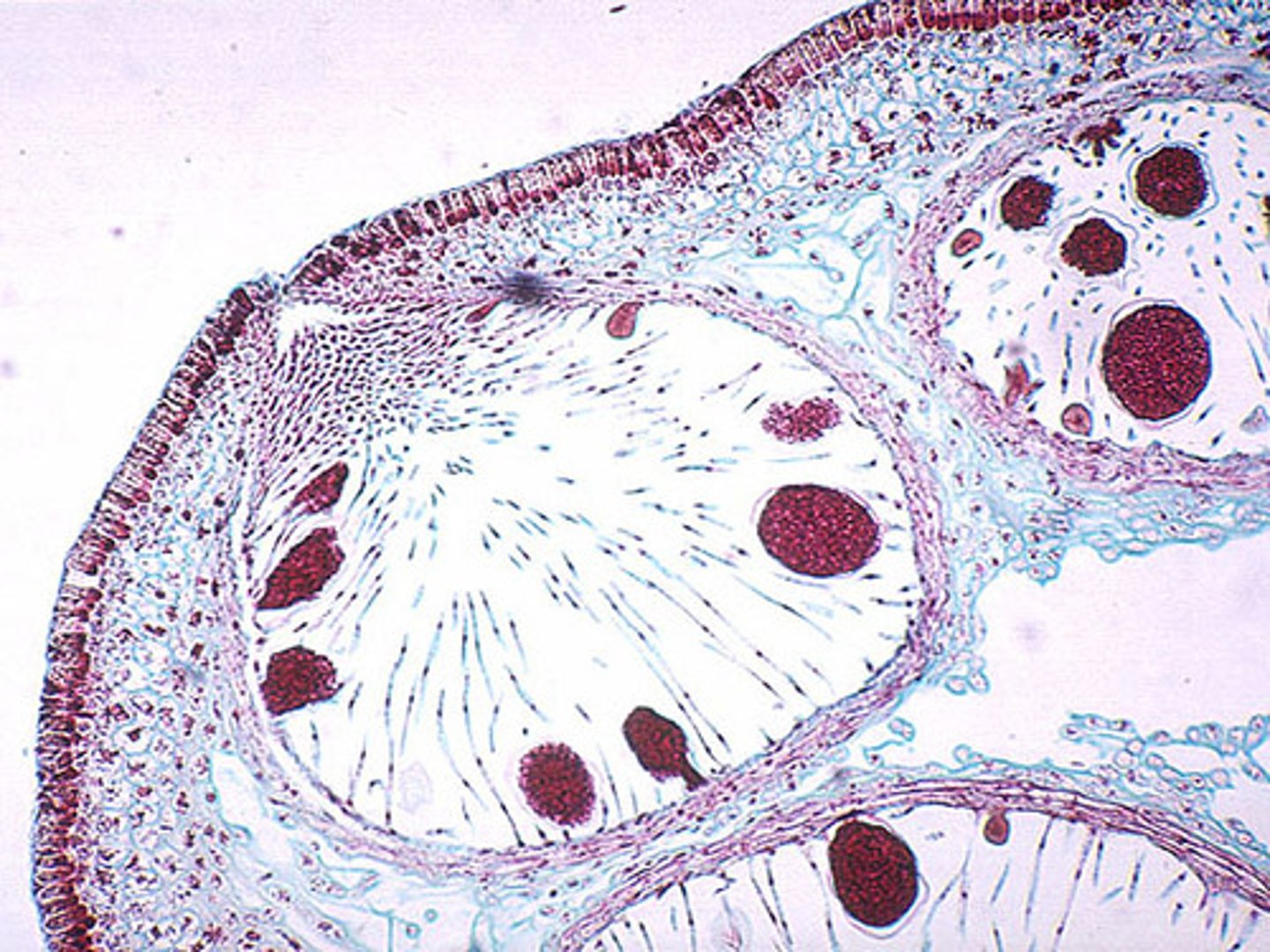 <p>in brown algae</p><p>is a chamber in a receptacle</p><p>that holds the gamete-</p><p>producing tissue</p>