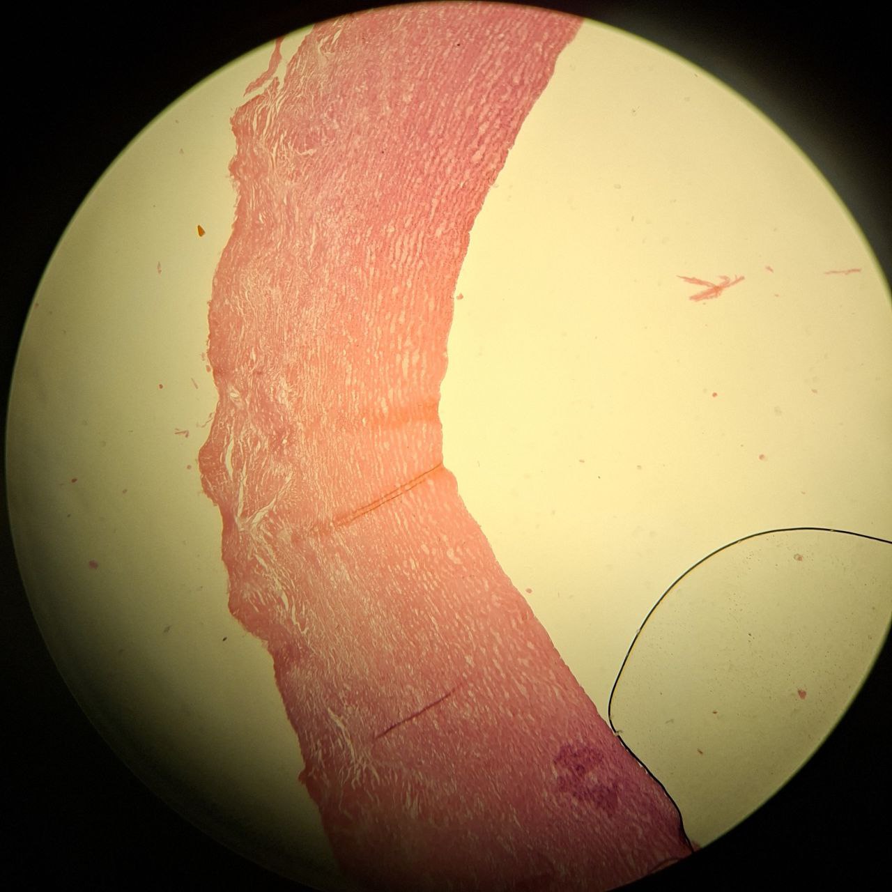 <p>Identify the tissue and mention one site</p>