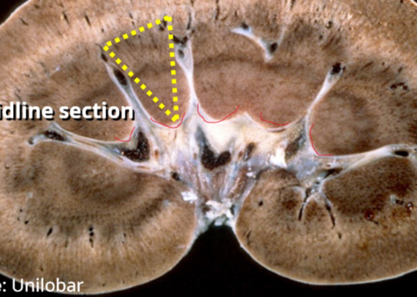 <p>papillae (lined in red)</p>
